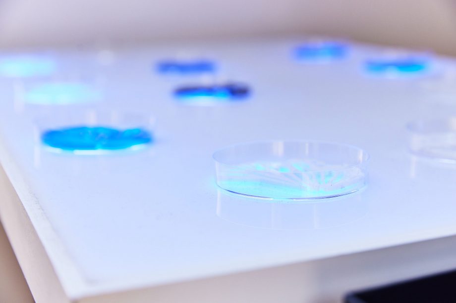 A close up of the petri dishes